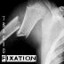Xmas by Tragic Fixation