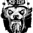 Acid Teeth